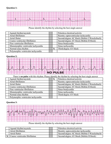  The Advanced Cardiovascular Life Support (ACLS) Precourse Self-Assessment is an online tool that evaluates a student’s knowledge before the course to determine their proficiency and identify any need for additional review and practice in 3 sections: rhythm recognition, pharmacology, and practical application. AHA ACLS Post Test Answer Key 2024 